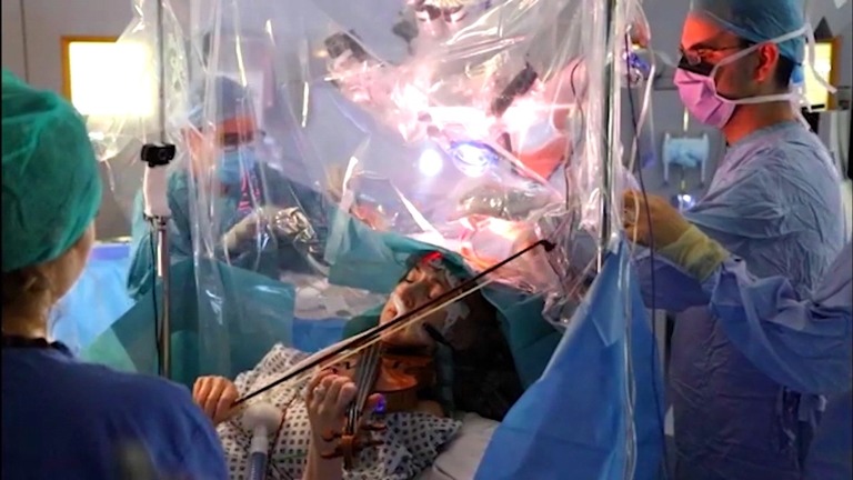 CNN.co.jp : 脳の手術中に患者がバイオリン演奏、医師が依頼　英